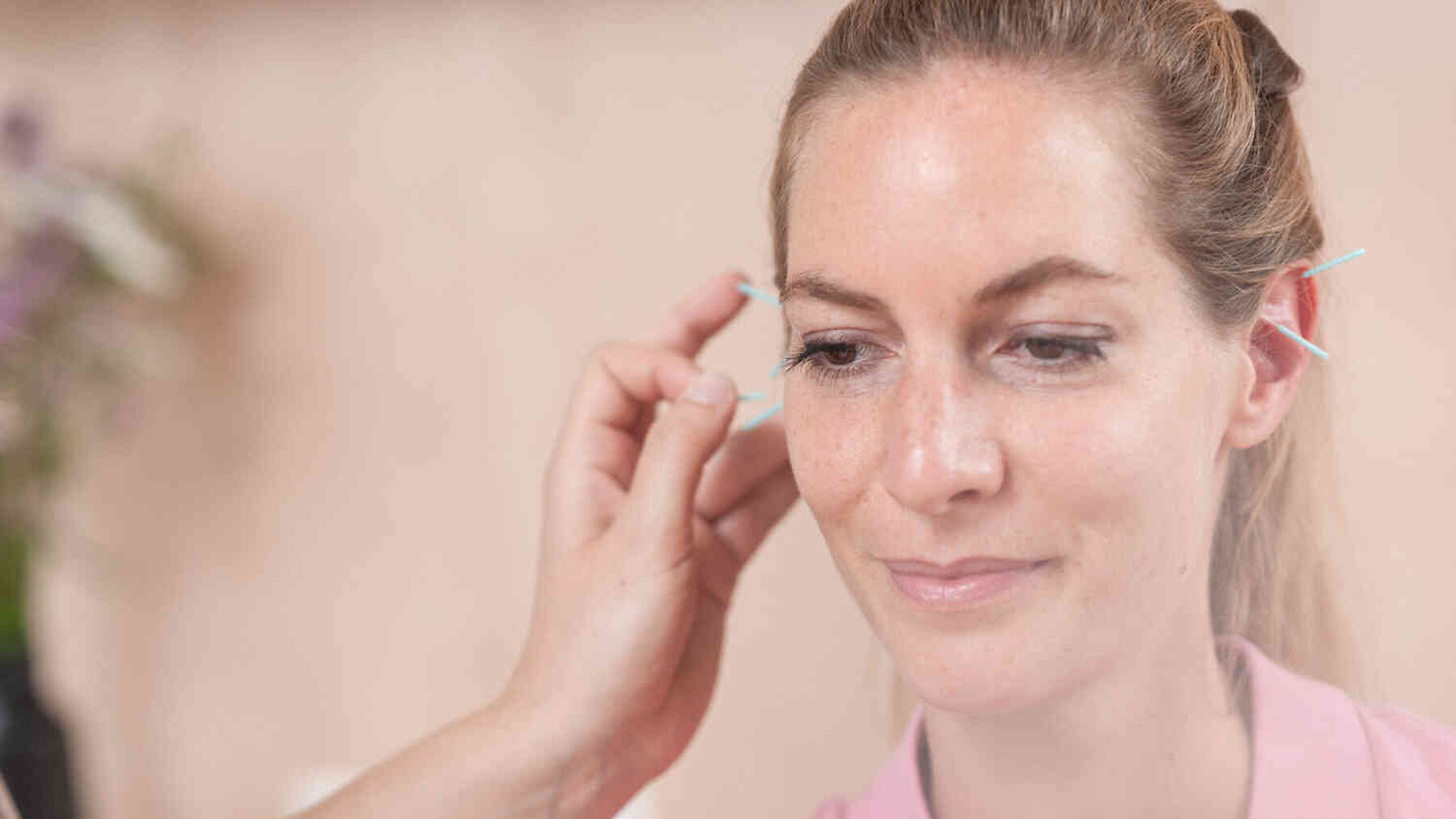 Nah aufnahme von Frau mit akupunktur im gesicht